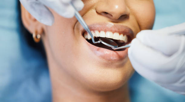 Best Emergency Broken Tooth Repair in Reston, VA
