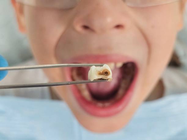 Best Same-Day Emergency Dentist in Reston, VA