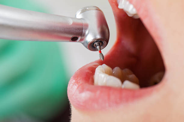 Best Emergency Orthodontic Repairs in Reston, VA